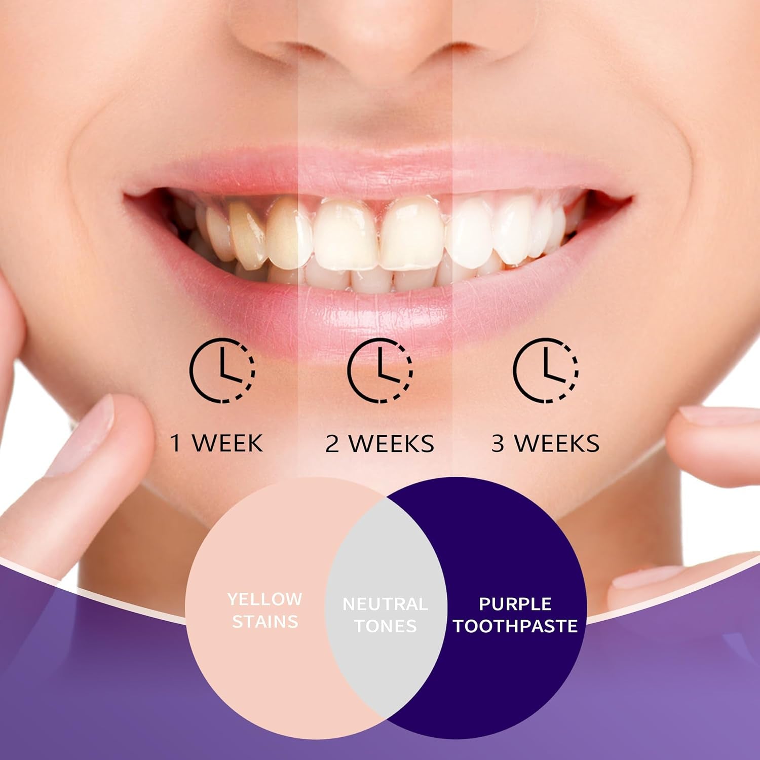 Purple Teeth Whitening Toothpaste, Color Correcting Purple Toothpaste for Teeth Whitening, Removal Stain for Adult Yellow Teeth