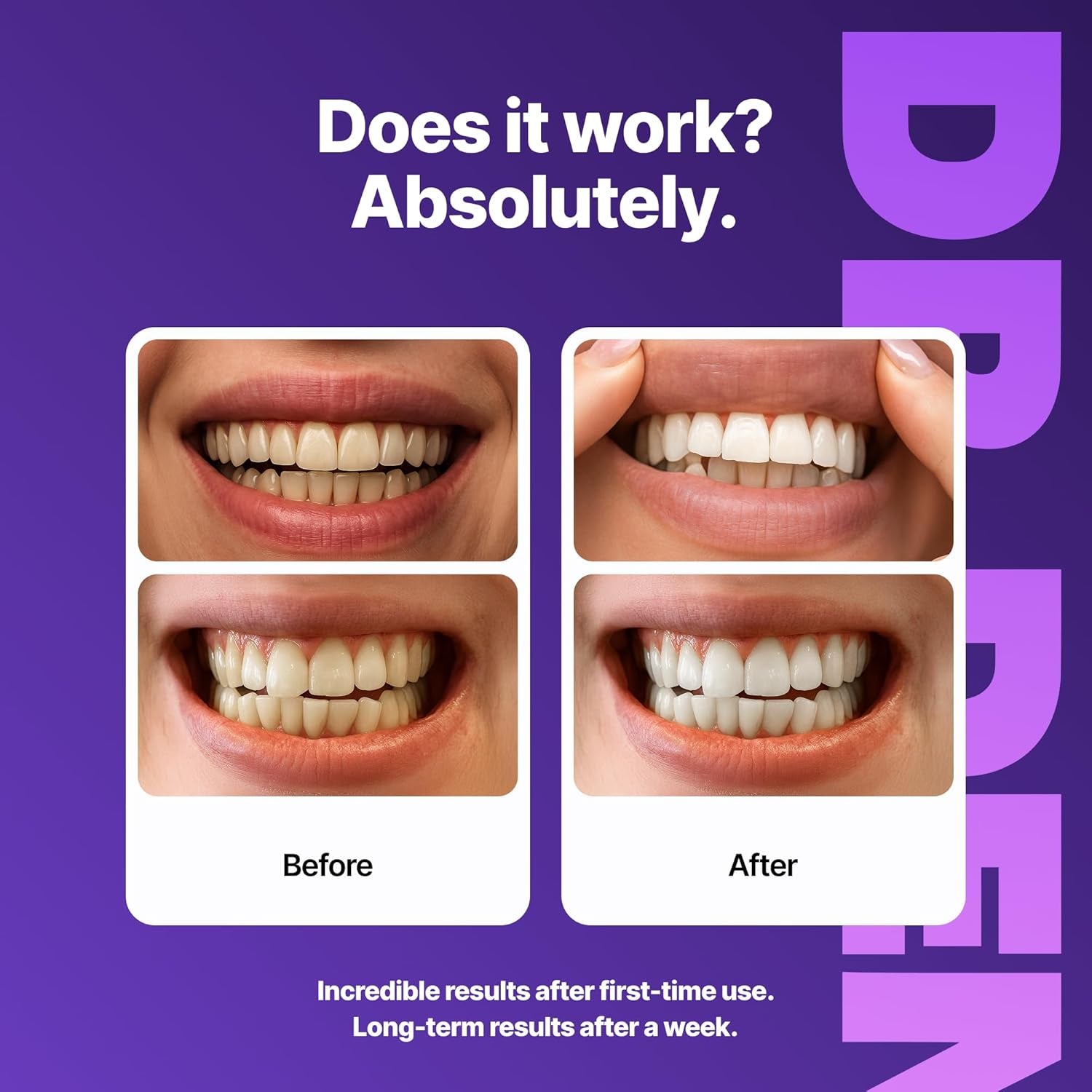DRDENT Purple Teeth Whitening Strips 21 Treatments - Safe for Enamel - Non Sensitive Teeth Whitening - Whitening without Any Harm - Pack of 42