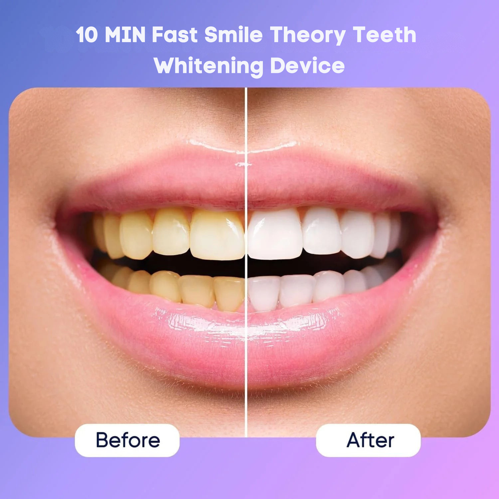 SmileTheory™ LED Teeth Whitening Device